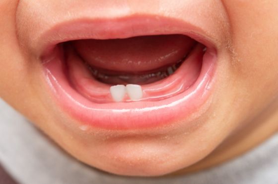 子どもの乳歯